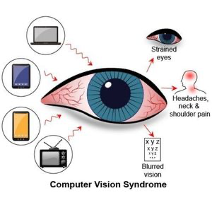 Diagram showing common computer vision syndrome symptoms including strained eyes, headache, neck and shoulder pain, and blurred vision